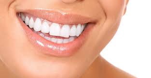 لبخندتان را با داشتن دندان هایی خارق العاده زیباتر کنید !