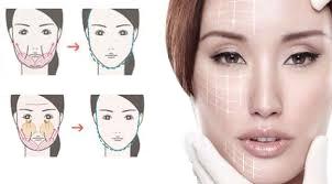 لیفت نخ چیست و چه مزایایی در عمل های زیبایی دارد ؟