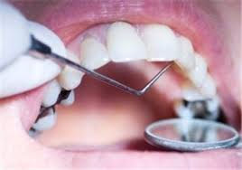 پریودنتولوژی و اطلاعاتی راجع به این علم دندانپزشکی